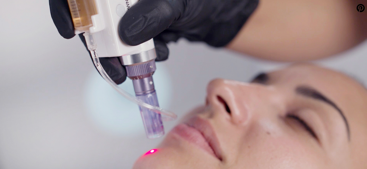 Microneedling by CASMARA - Advanced Formula - 60 min