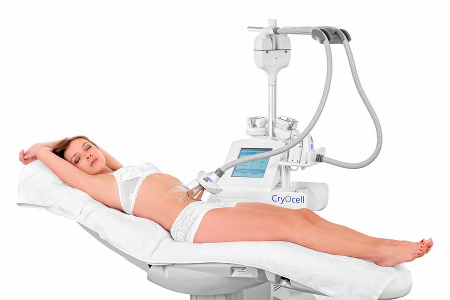 Cryolipolyse à Paris - Séance 1h